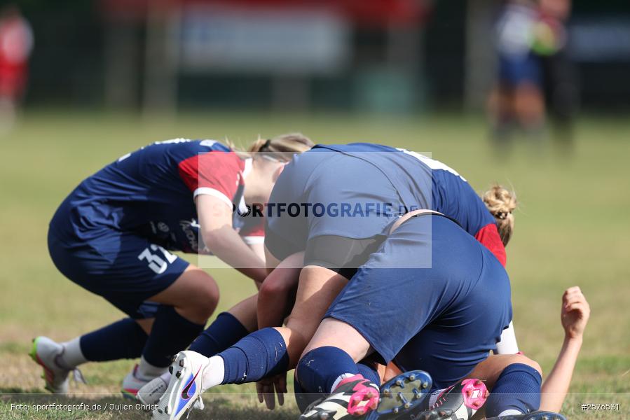 sport, Verbandspokal, Sportgelände, Karsbach, Fussball, FFC Adelsberg-Karsbach, FC Würzburger Kickers, BFV, Achtelfinale, 22.08.2026 - Bild-ID: 2576531